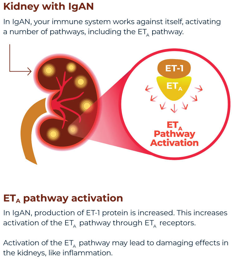 Kidney with IgAN. In IgAN, your immune system works against itself, activating a number of pathways, including the ETA pathway. ETA pathway activation. In IgAN, production of ET-1 protein is increased. This increases activation of the ETA pathway through ETA receptors. Activation of the ETA pathway may lead to damaging effects in the kidneys, like inflammation.
