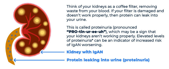 Think of your kidneys as a coffee filter, removing waste from your blood. If your filter is damaged and doesn't work properly, then protein can leak into your urine. This is called proteinuria (pronounced "PRO-tin-ur-ee-uh"), which may be a sign that your kidneys aren't working properly. Elevated levels of proteinuria can be an indicator of increased risk of IgAN worsening.
